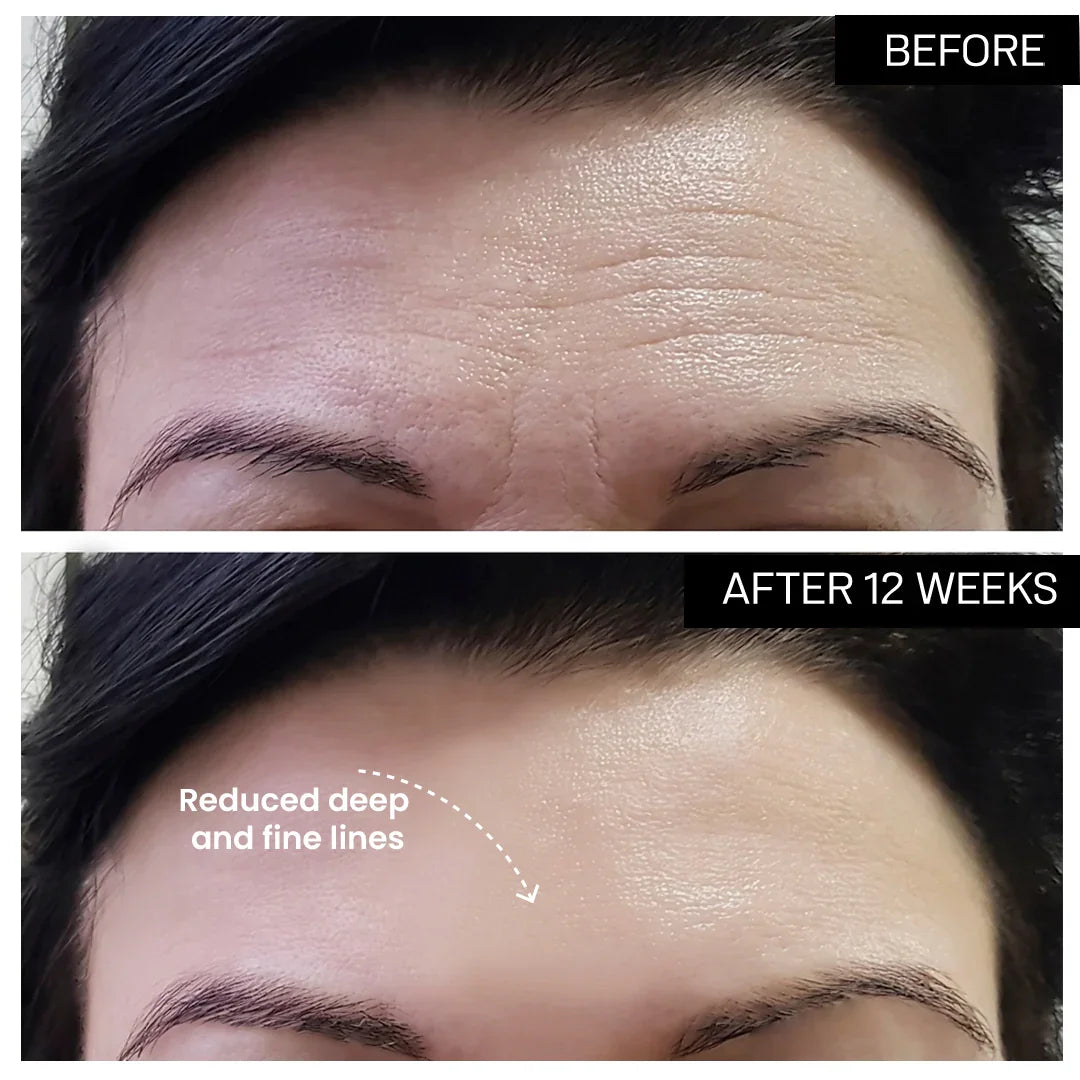 Micro-Current Face Sculpting Device