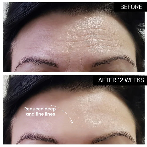 Micro-Current Face Sculpting Device