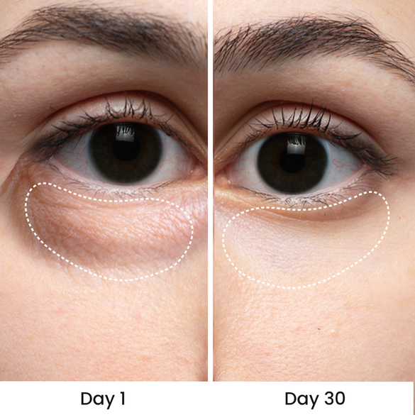 Red light therapy facial wand