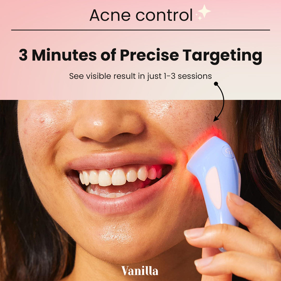 Acne Control Light therapy device