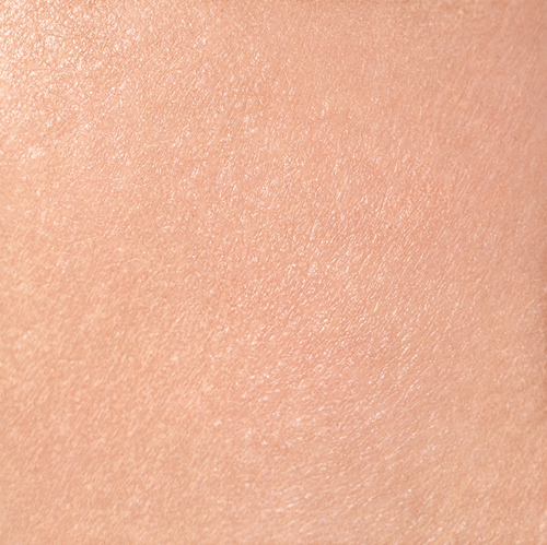 After treatment