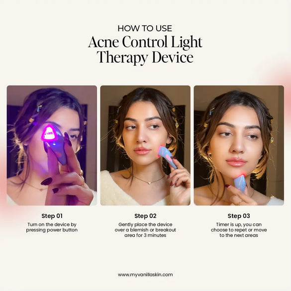 Acne Control Light therapy device