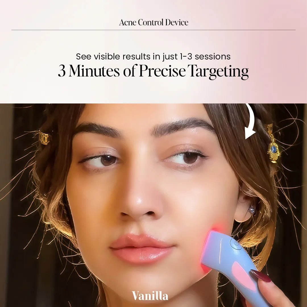 Acne Control Light therapy device