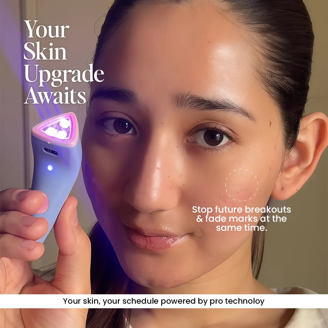 Acne Control Light therapy device
