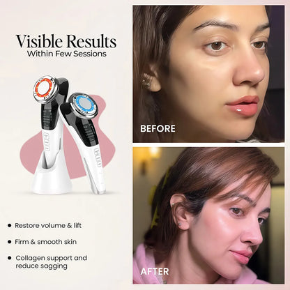 EMS light therapy device