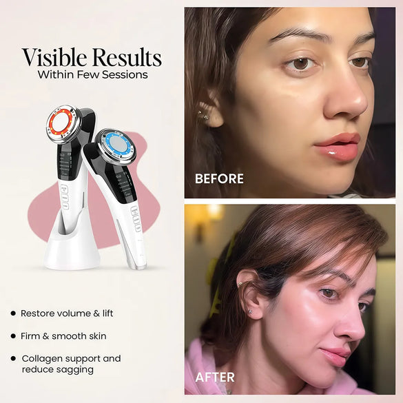 EMS light therapy device